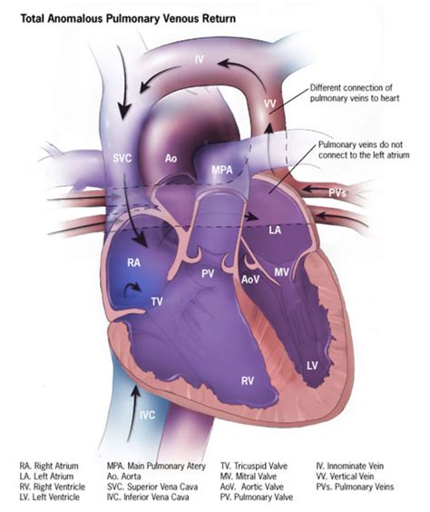 Venas Pulmonares