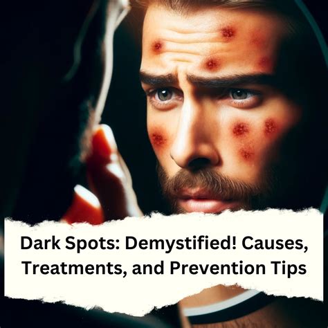 Dark Spots: Demystified! Causes, Treatments, and Prevention Tips - theone.skin