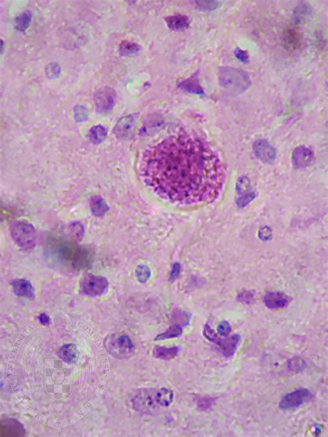 Biology Group4 - Sakthi Thanigai Toxoplasma gondii