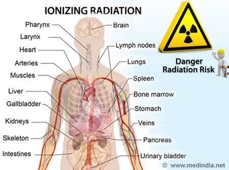 Infographic on Radiation Hazards