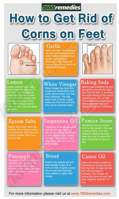 Pin by Natural Remedies * on Home Remedies | Get rid of corns, Foot remedies, Corn removal