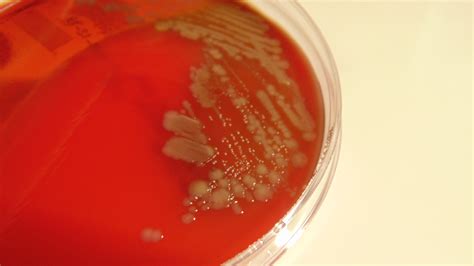 Bacteria on Blood Agar | BackYard Chickens - Learn How to Raise Chickens