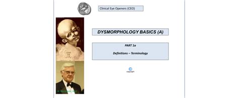 Part 1a of Dysmorphology Basics (A) – Clinical Eye Openers