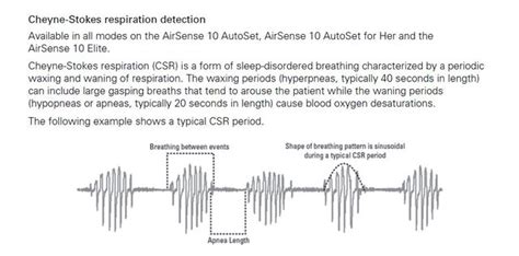 Is this cheyne stokes breathing? | CPAPtalk.com