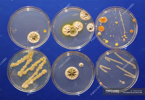 Petri Dish Bacteria Identification