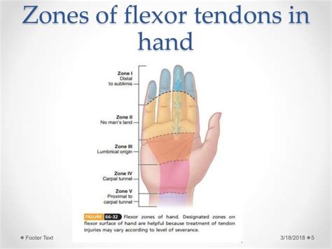 Flexor tendon injuries