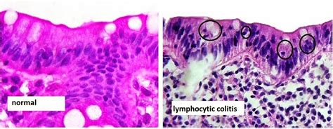 GASTROINTESTINAL AND LIVER HISTOLOGY PATHOLOGY ATLAS: August 2014