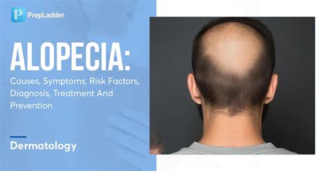 Alopecia: Causes, Symptoms, Risk Factors, Diagnosis, Treatment and Prevention