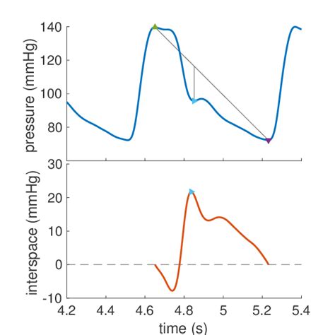 The dicrotic notch was automatically identified on the arterial ...