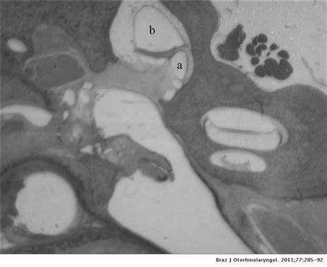 Histology of sheep temporal bone | Brazilian Journal of ...