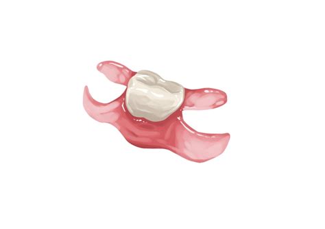 What are the flexible partial dentures? | Authority Dental