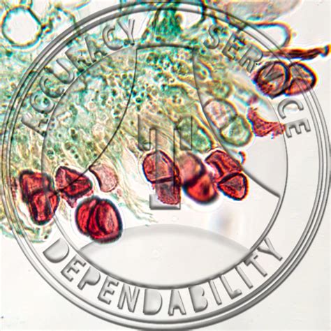 Puccinia fusca Anemone Prepared Microscope Slide