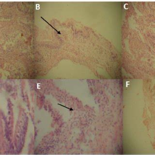 Photomicrographs of helminth parasites. A: Cephalic region of... | Download Scientific Diagram