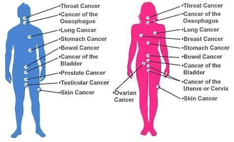 2: Illustration of the most common types of cancers in various organs ...