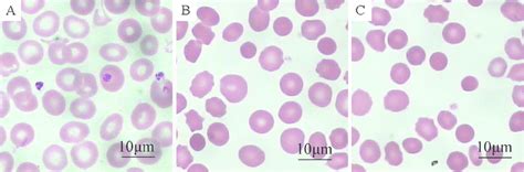 Optical microscopy images of peripheral blood smears of normal control ...