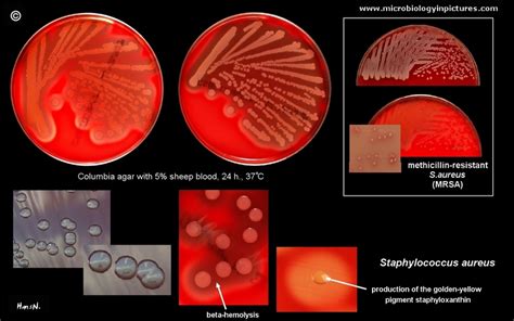 Novedad Silicio recurso renovable colonia de staphylococcus aureus caja ...