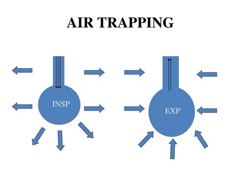 PPT - Obstructive Airway Disease PowerPoint Presentation, free download ...