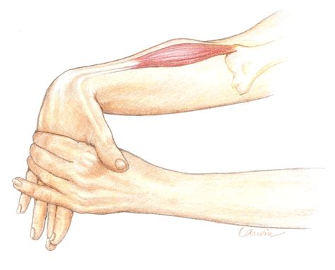 Tennis Elbow Exercises - Heal Fast and Strong - PhysioPrescription