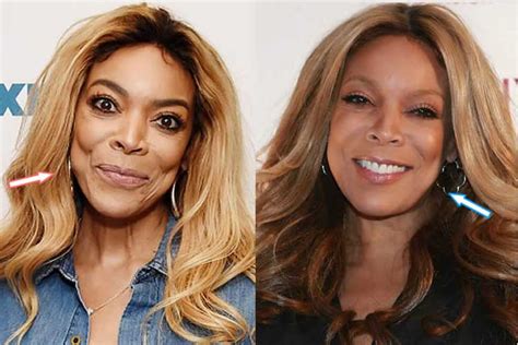 Wendy Williams Plastic Surgery: Nose Job, Breast Implants, Facelift