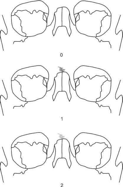 Character states for the inferior nasal aperture morphology. | Download Scientific Diagram