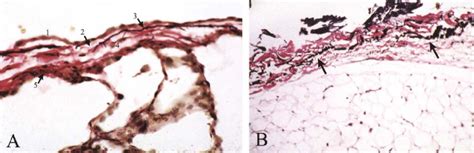 35. Pleura. A. Visceral pleura. The five pleural layers can be seen in... | Download Scientific ...