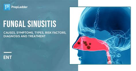 Fungal Sinusitis: Causes, Symptoms, Types, Risk Factors and More