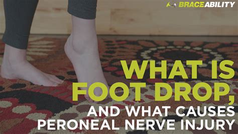 What Is Foot Drop (and What Causes This Peroneal Nerve Injury)?