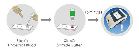 Buy Wholesale China Digestive Function Test Pgi And Pgii Test Fluorescence Immunoassay Method ...