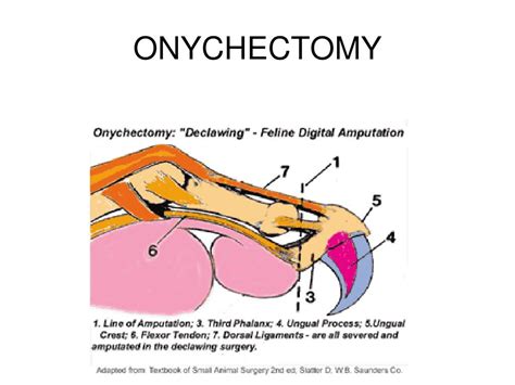 PPT - ONYCHECTOMY PowerPoint Presentation, free download - ID:4806357