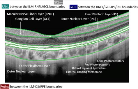 OCT for showing the total retina (from ILM to the boundary between the ...