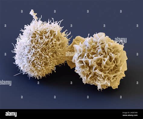 Dendritic cells, coloured scanning electron micrograph (SEM). These ...