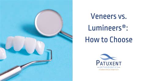 Veneers vs. Lumineers: How to Choose