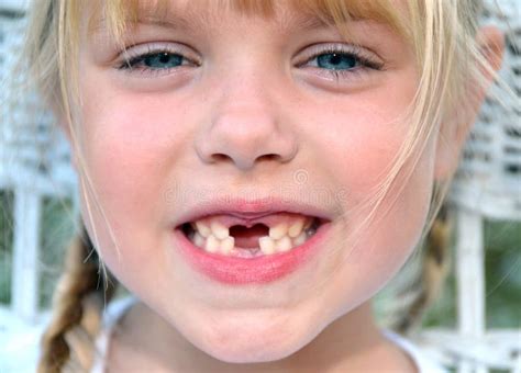 Girl Missing Teeth Royalty Free Stock Images - Image: 21734349