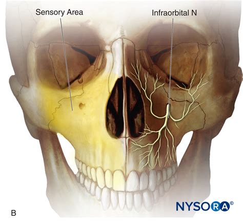 Ann Young On X: Anatomy Review: The Infraorbital Nerve Is A, 59% OFF