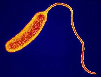 Genomes of Cholera Bacteria from Haiti confirms Epidemic originated ...