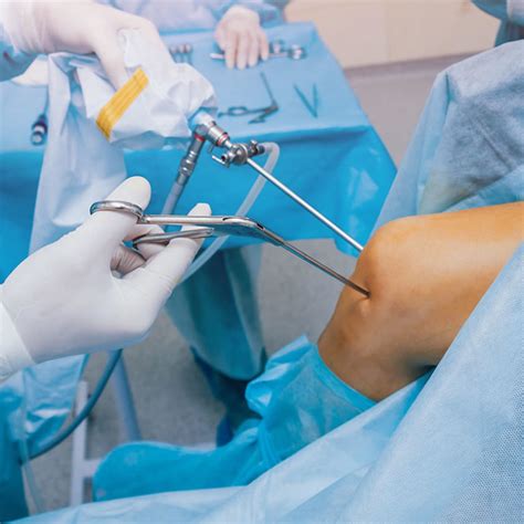 Knee Arthroscopy | Cape Hip and Knee, Cape Town