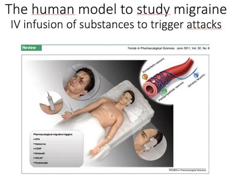 The cause of migraine: it’s all in your brain! The electrical and chemical sides of migraine ...