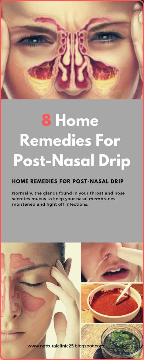 8 Home Remedies For Post-Nasal Drip | Remedies, Herbal medicine, Home remedies