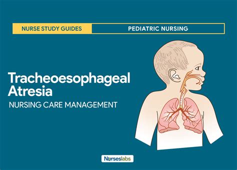 Tracheoesophageal Atresia Nursing Care Management and Study Guide | Nursing study guide ...