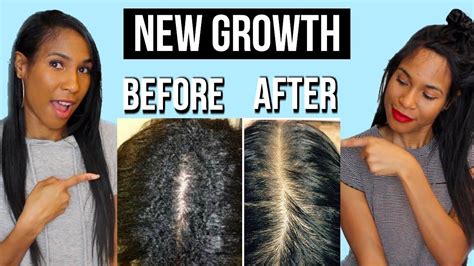 https://www.youtube.com/watch?v=OgELXwPAm80 | Relaxed hair growth ...