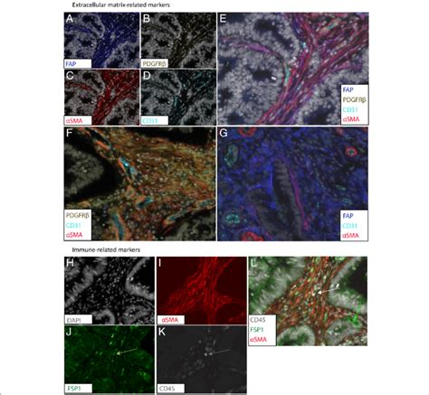 Multiplex analysis of cancer-associated fibroblast markers in a cohort... | Download Scientific ...