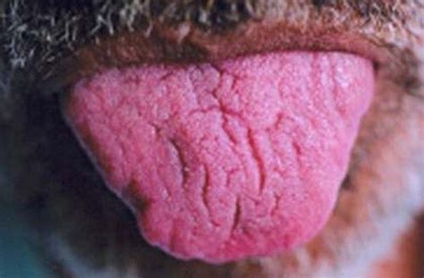 Fissured Tongue - Pictures, Causes, Features and Cure