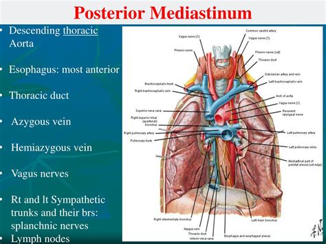 PPT - Mediastinum PowerPoint Presentation, free download - ID:5617803