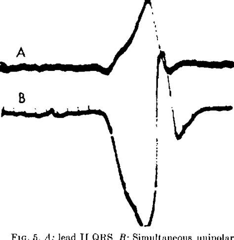 membrane depolarization during ventricular cardiac muscle cell action ...