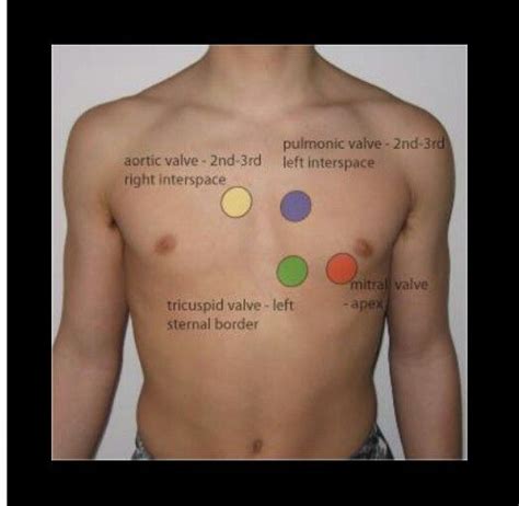 Assessing Apical Pulse | Nursing | Pinterest