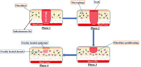 Different phases of the wound-healing process. | Download Scientific ...