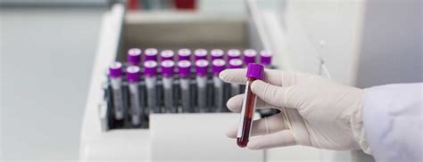 Blood Test | Johns Hopkins Medicine