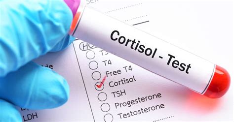 Cortisol level test: Purpose, procedure, and results