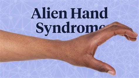 Alien Hand Syndrome | Ausmed