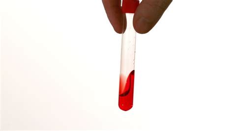 What is Autotransfusion? | Low-Cost autotransfusion